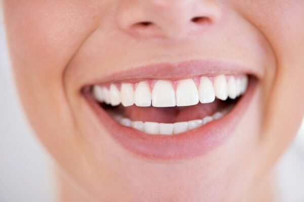 Your Teeth
